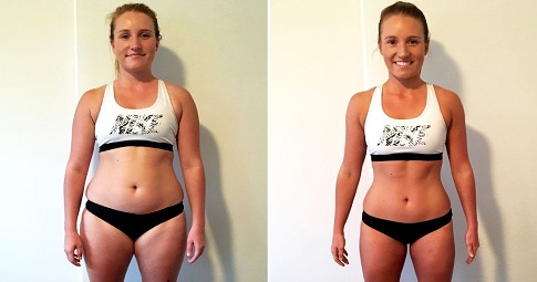 Post-weight loss surgery before and after
