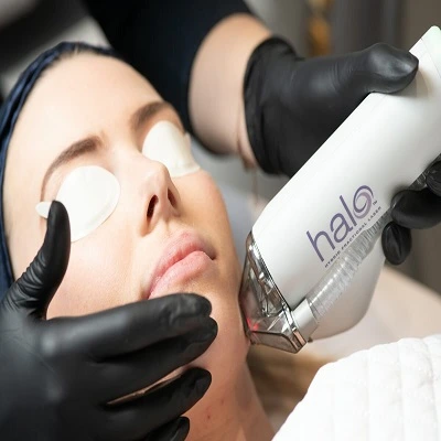 Halo Treatment in Dubai
