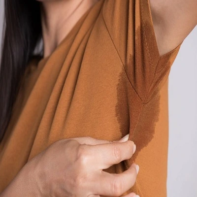 Hyperhidrosis Treatment in Dubai