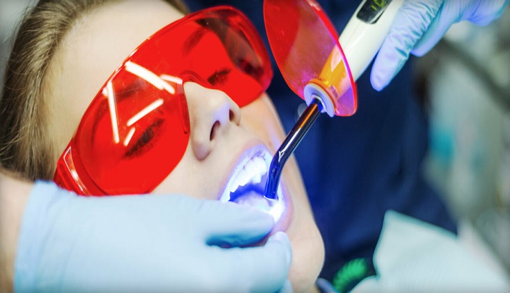 Laser gum whitening in Dubai