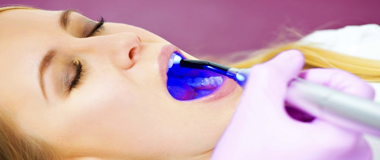 Laser gum whitening in Dubai