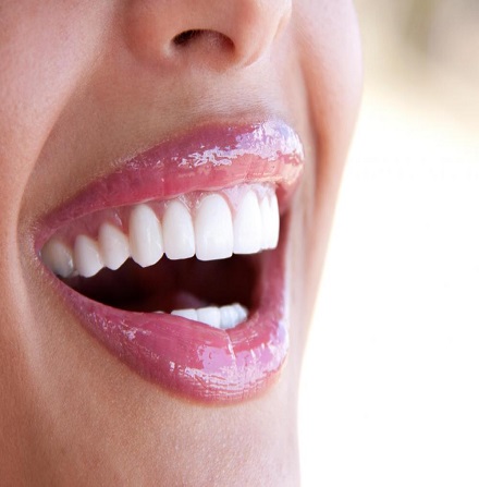 Laser gum whitening in Dubai