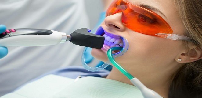 Laser gum whitening in Dubai