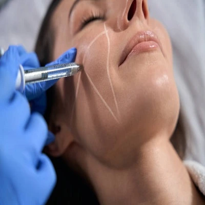Sculptra Fillers in Dubai