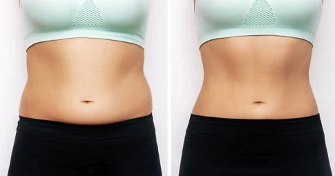 Body Sculpting before and after