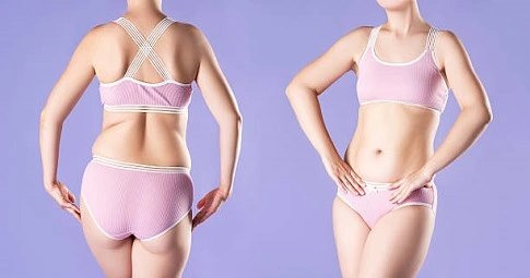 Body Sculpting before and after