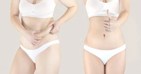 Body Sculpting before and after
