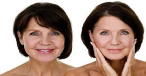 Facelift in Dubai