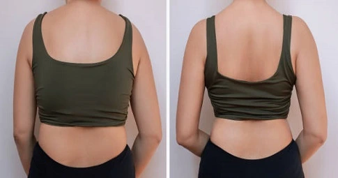 Waist Scuplting Before and After