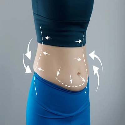 Circumferential Tummy Tuck in Dubai