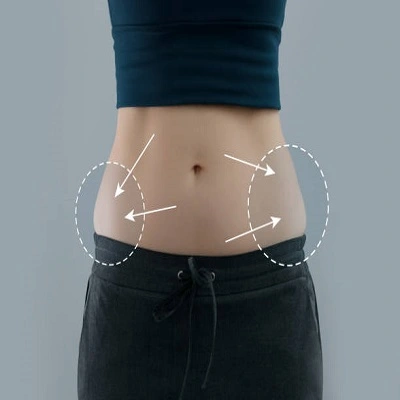 Circumferential Tummy Tuck in Dubai