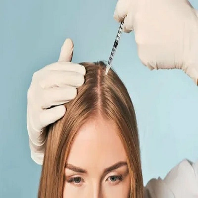 Exosome Hair Therapy in Dubai