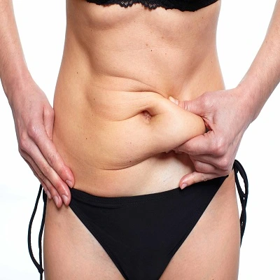 HD Liposuction in Dubai
