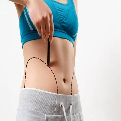 HD Liposuction in Dubai