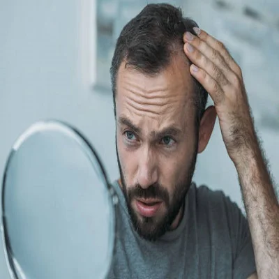Hair Loss Treatment in Dubai