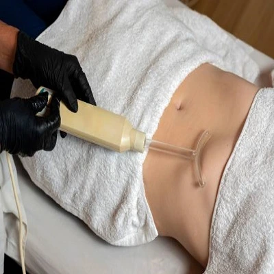 Lipomatic treatment in Dubai