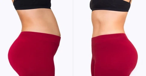 Lipomatic treatment before and after