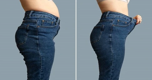 MILA Surgery before and after