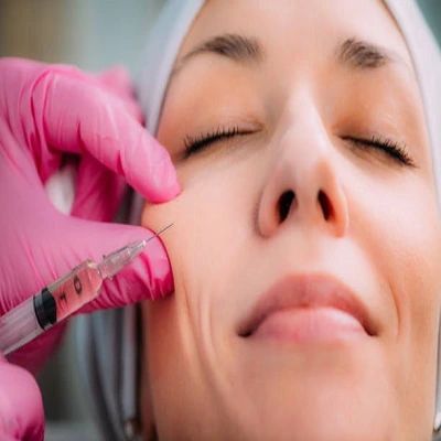 Cheek Filler Injections in Dubai