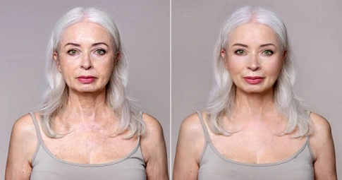 Magical Facelift in Dubai