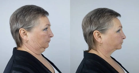 Magical Facelift in Dubai