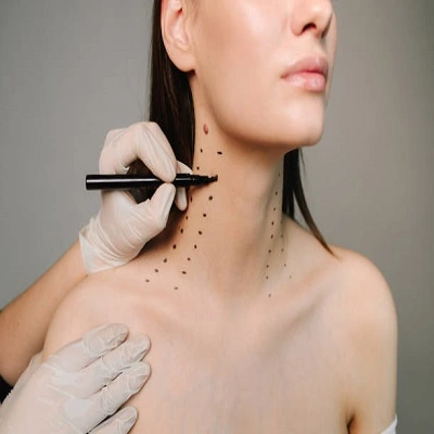 Nefertiti Lift Treatment in Dubai & UAE