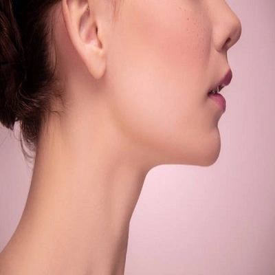 Nefertiti Lift Treatment in Dubai & UAE