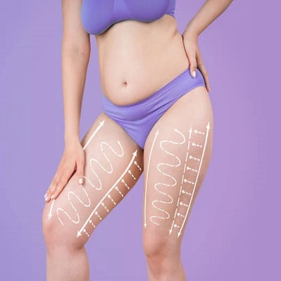 Thigh Lift in Dubai