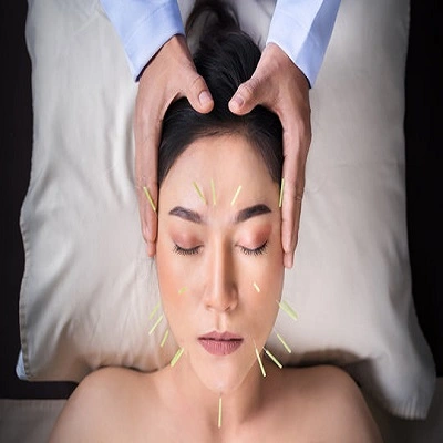 Acupuncture Treatment in Dubai & UAE