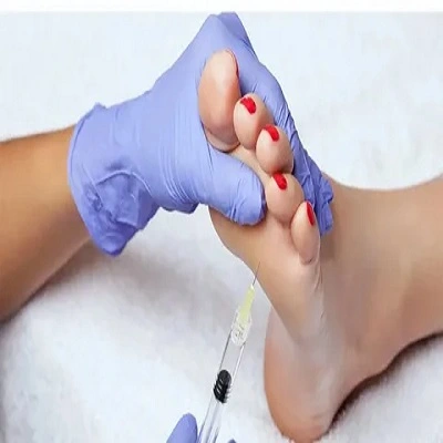 Botox Injection To Treat Sweaty Feet in Dubai & UAE