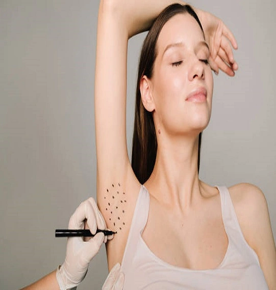 Botox injections for Sweaty Glands in Dubai