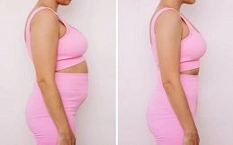 Mounajro Needles before and after