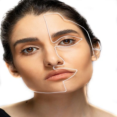 Restylane Lift in Dubai & UAE