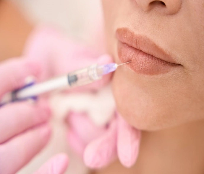 Volbella Fillers in Dubai