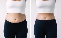 What Areas are Treated with Fat Dissolving Injections