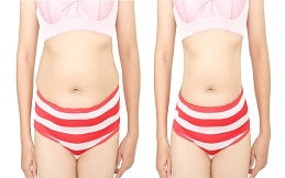 What Areas are Treated with Fat Dissolving Injections
