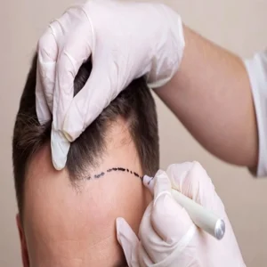 Cost of G-Cell Treatment in Dubai