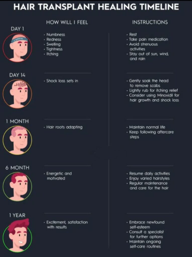 Hair Transplant Healing time line