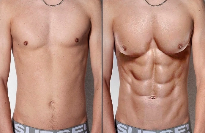 Six Pack Abs Surgery before and after