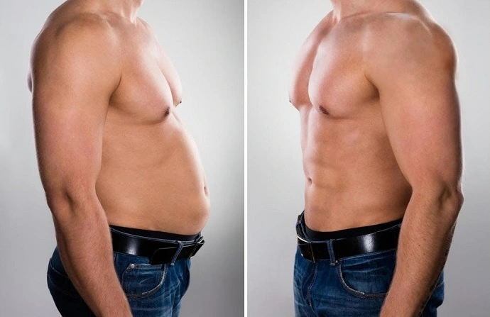 Six Pack Abs Surgery before and after