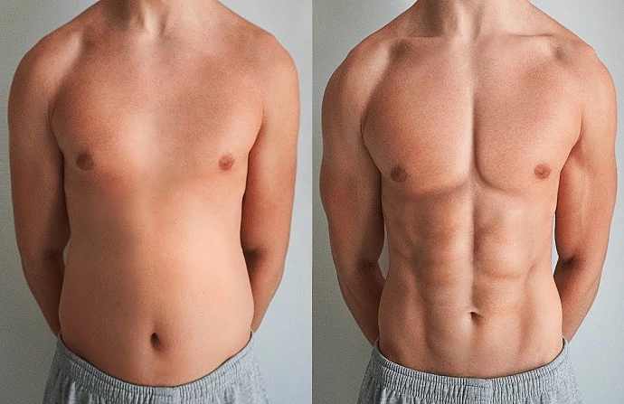 Six Pack Abs Surgery before and after
