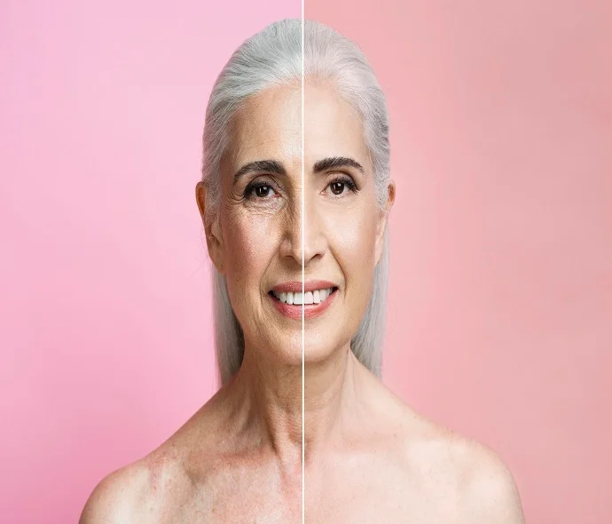 Anti-Aging Treatment in Dubai