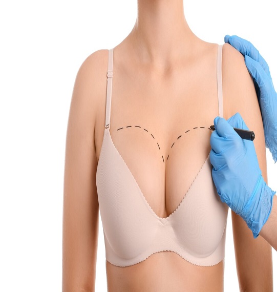 Breast Lift in Dubai