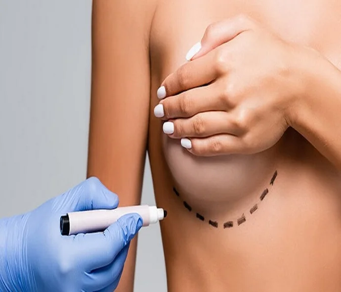 Breast Reduction in Dubai