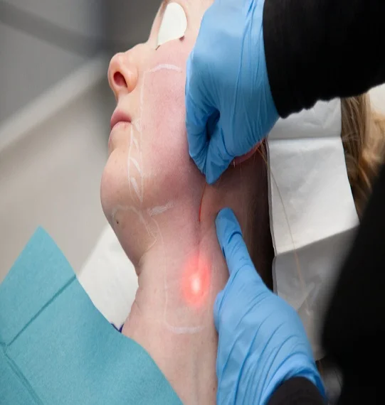 Endolift Treatment in Dubai