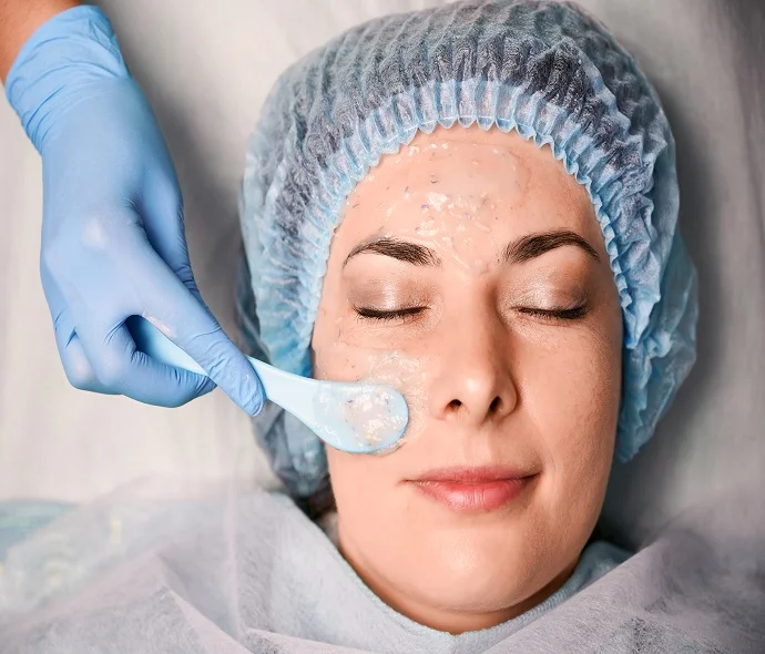PCA Chemical Peel Treatement in Dubai