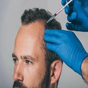 Areas Treated with Plasma Injection for Hair