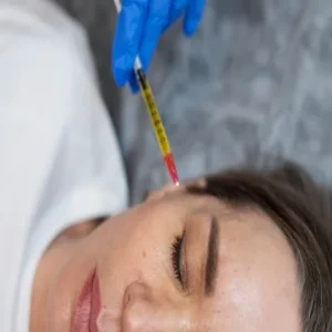 The Best and Cheapest Platelet-rich Plasma Treatment