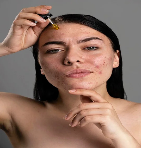 Skin Pigmentation in Dubai