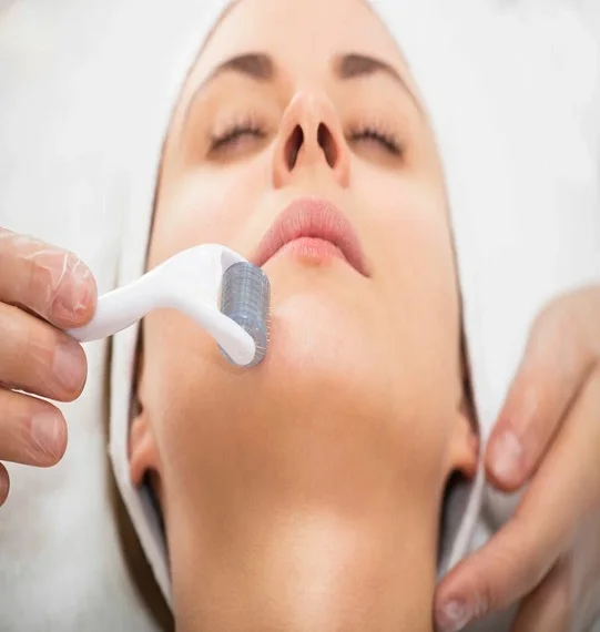 Derma Roller Treatment in Dubai